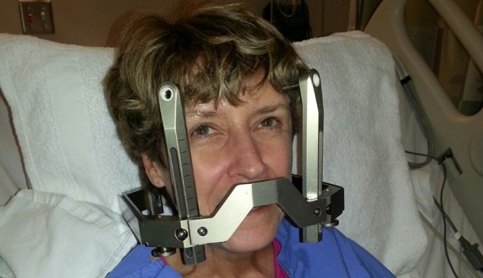 Breast and lung cancer survivor: My Gamma Knife surgery | MD Anderson