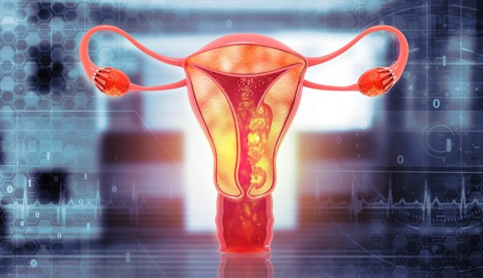 ‘How I knew I had endometrial cancer’: Survivors share their stories
