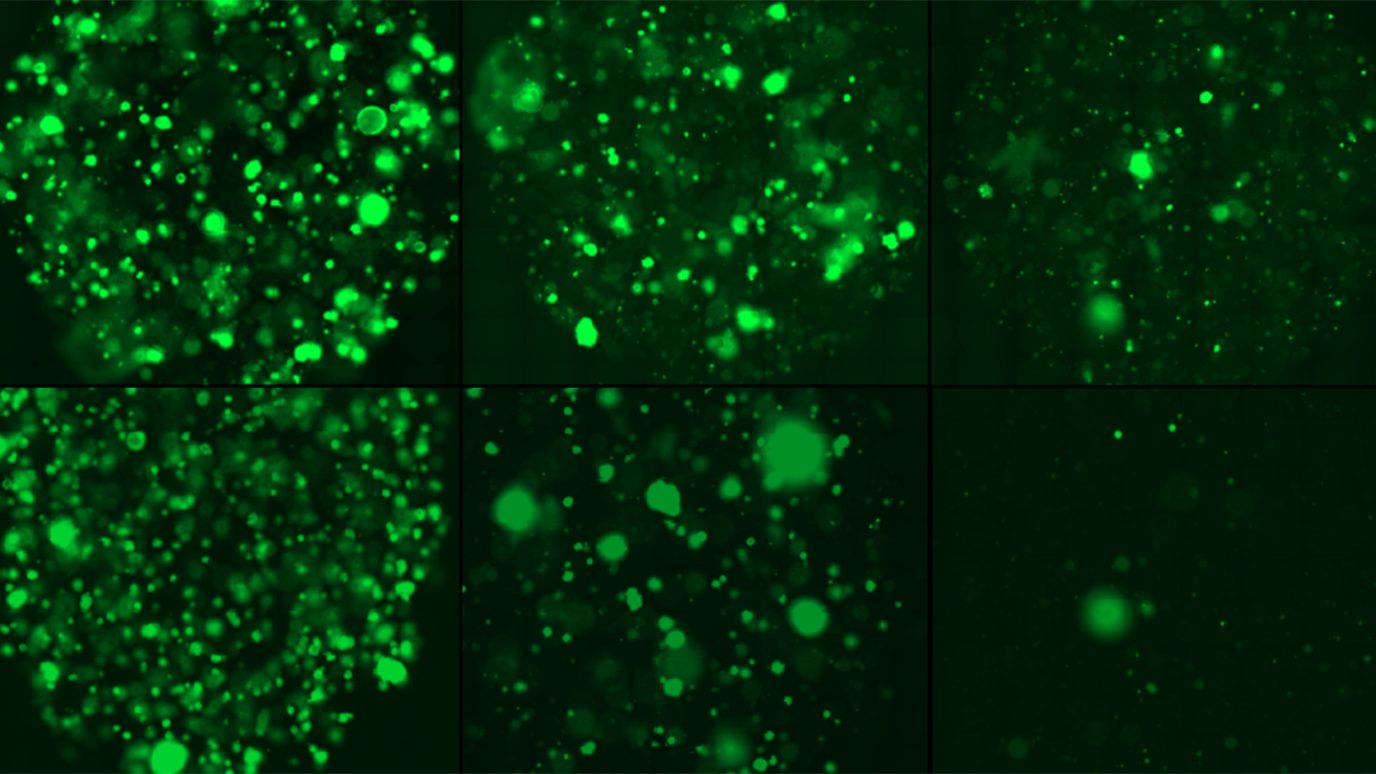 Bright green fluorescence images show the viability of SPOP-mutant prostate tumor organoids following ferroptosis-inducing at different dose levels. 