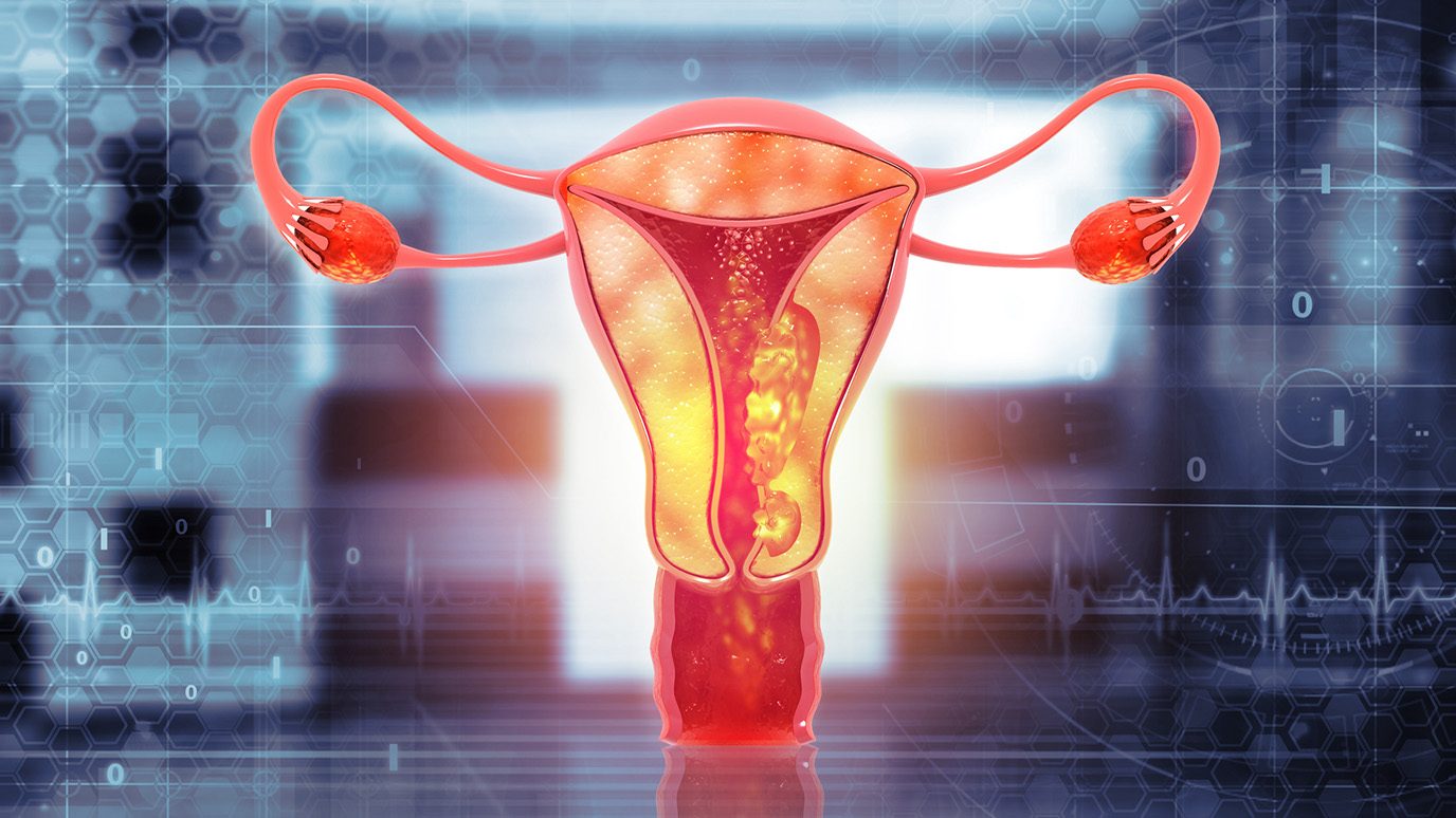 Medical illustration of female internal reproductive system against a busy gray abstract background