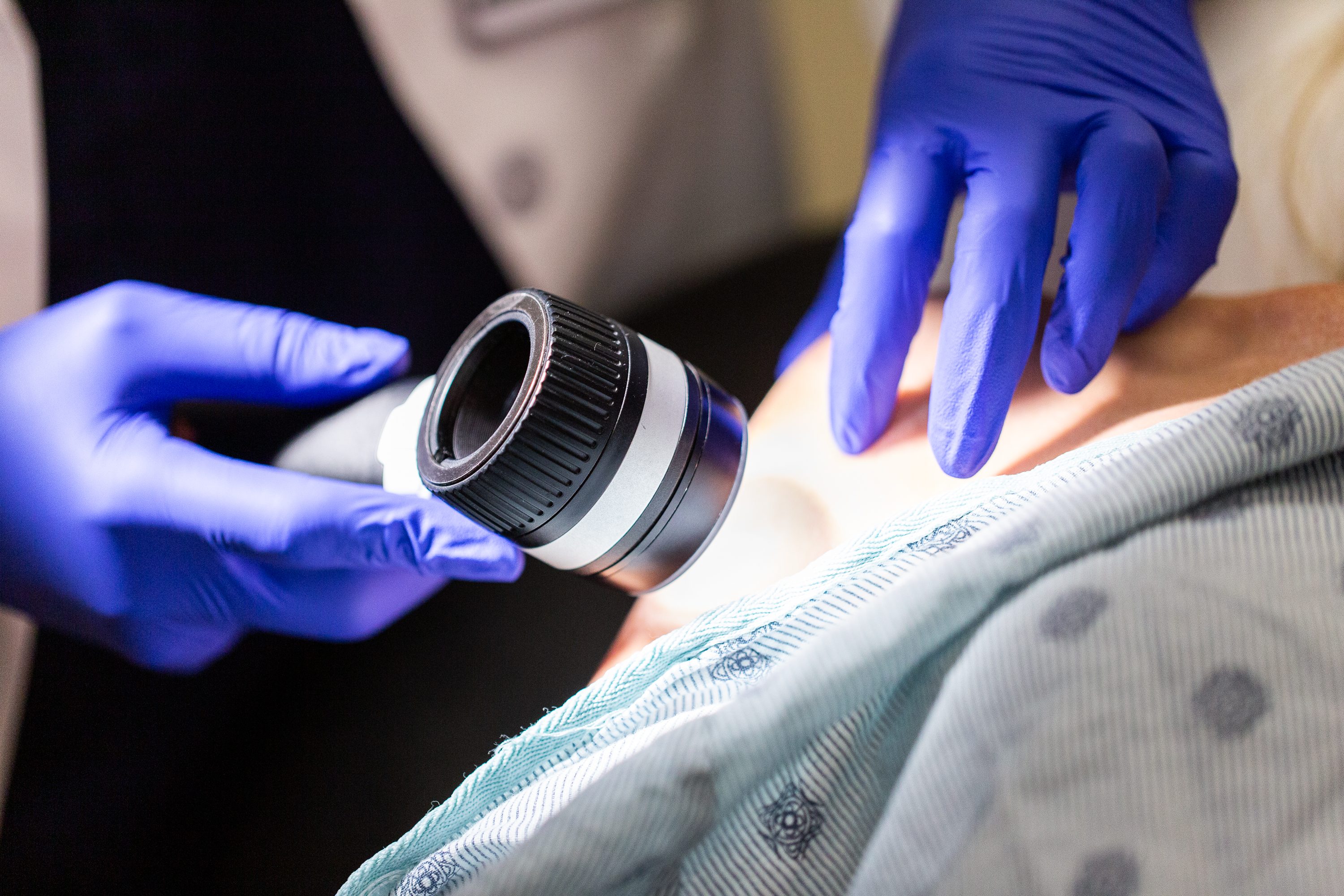 A gloved dermatologist uses a scope to examine a patient's skin 
