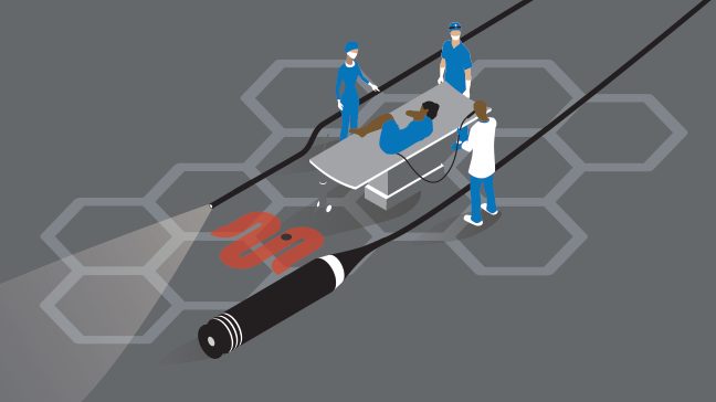 Illustration of a woman lying on a table before for an endoscopic exam