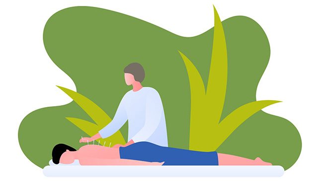 Graphic of acupuncturist placing needles into a patient's back.