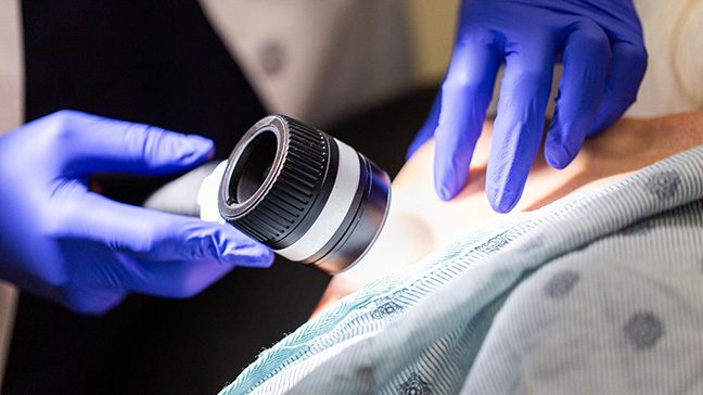 Gloved hands hold a black dermatoscope tool to a patient's shoulder.