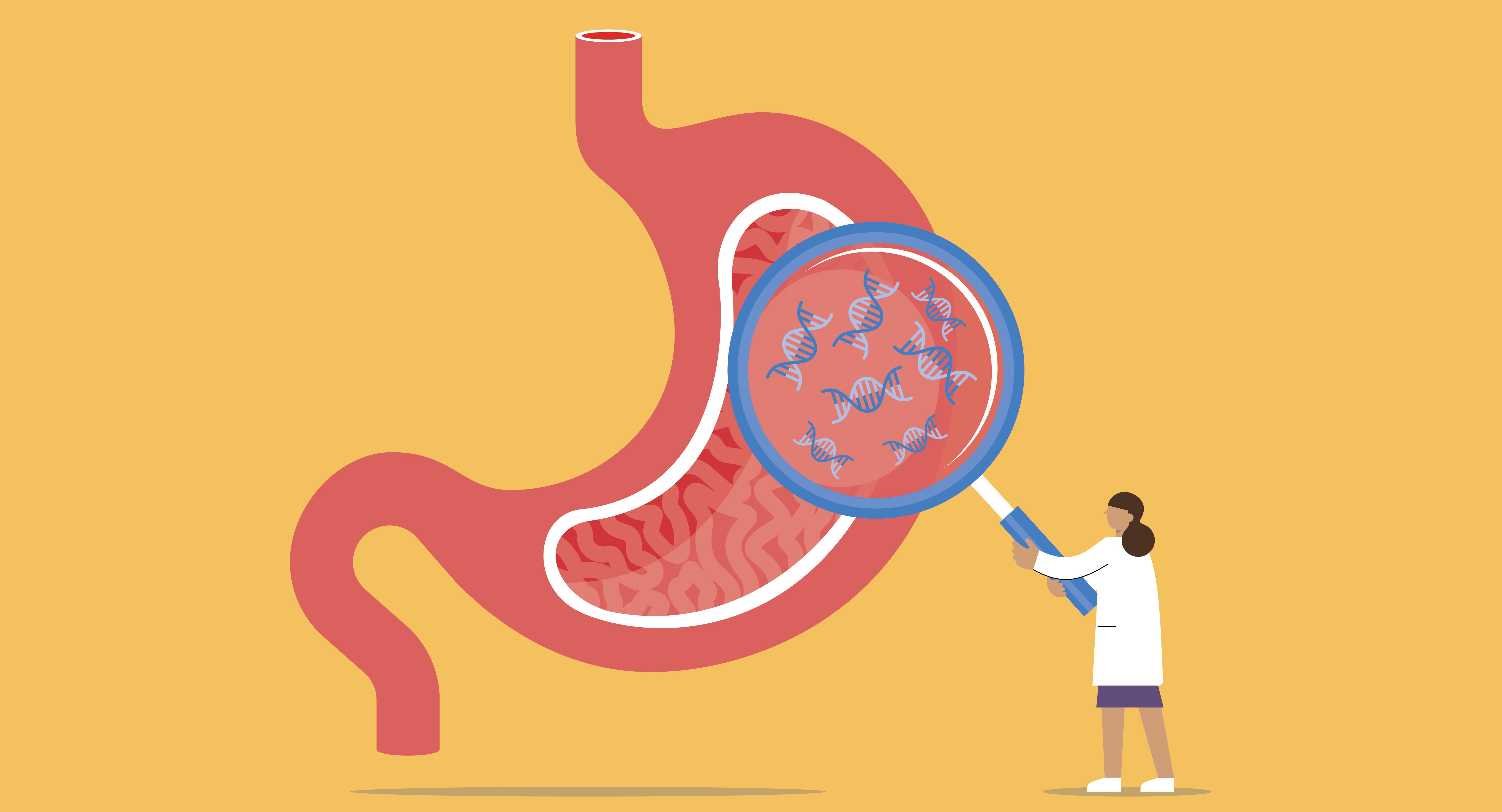 Graphic of a doctor holding a magnifying glass to a stomach showing genetic mutations 