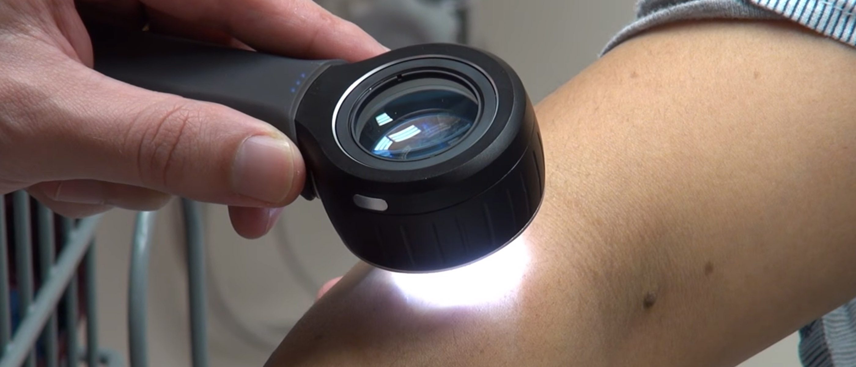 Skin Cancer Md Anderson Cancer Center