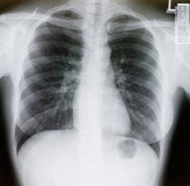 can you check cigarettes US adult cigarette smoking rate hits another all-time low