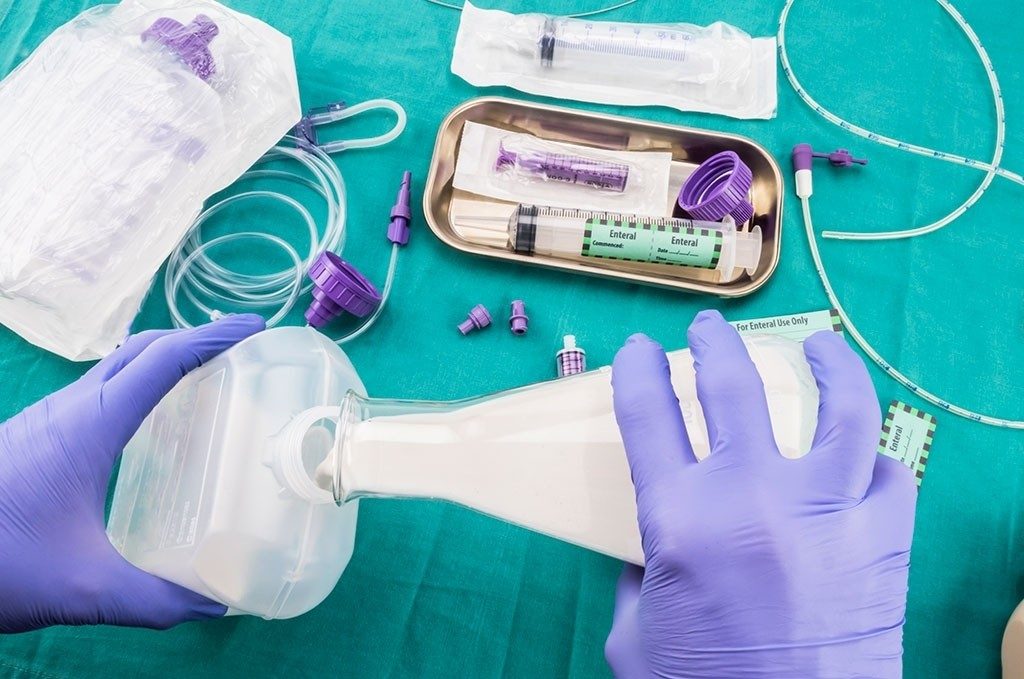 Photograph of formula being prepared for a feeding tube