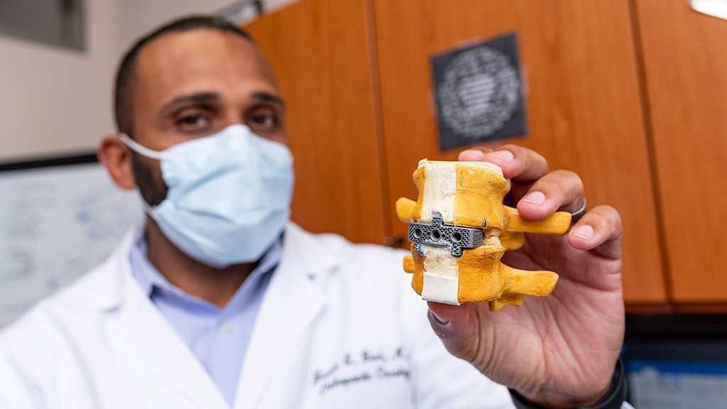 Justin Bird, M.D., holds up the spinal implant he developed while wearing his white coat and medical-grade face mask.