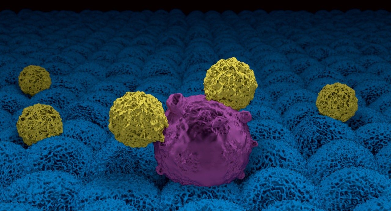 Two smaller yellow CAR T cells attack one larger purple cancer cell. They are on top of a bed of many blue cells. 