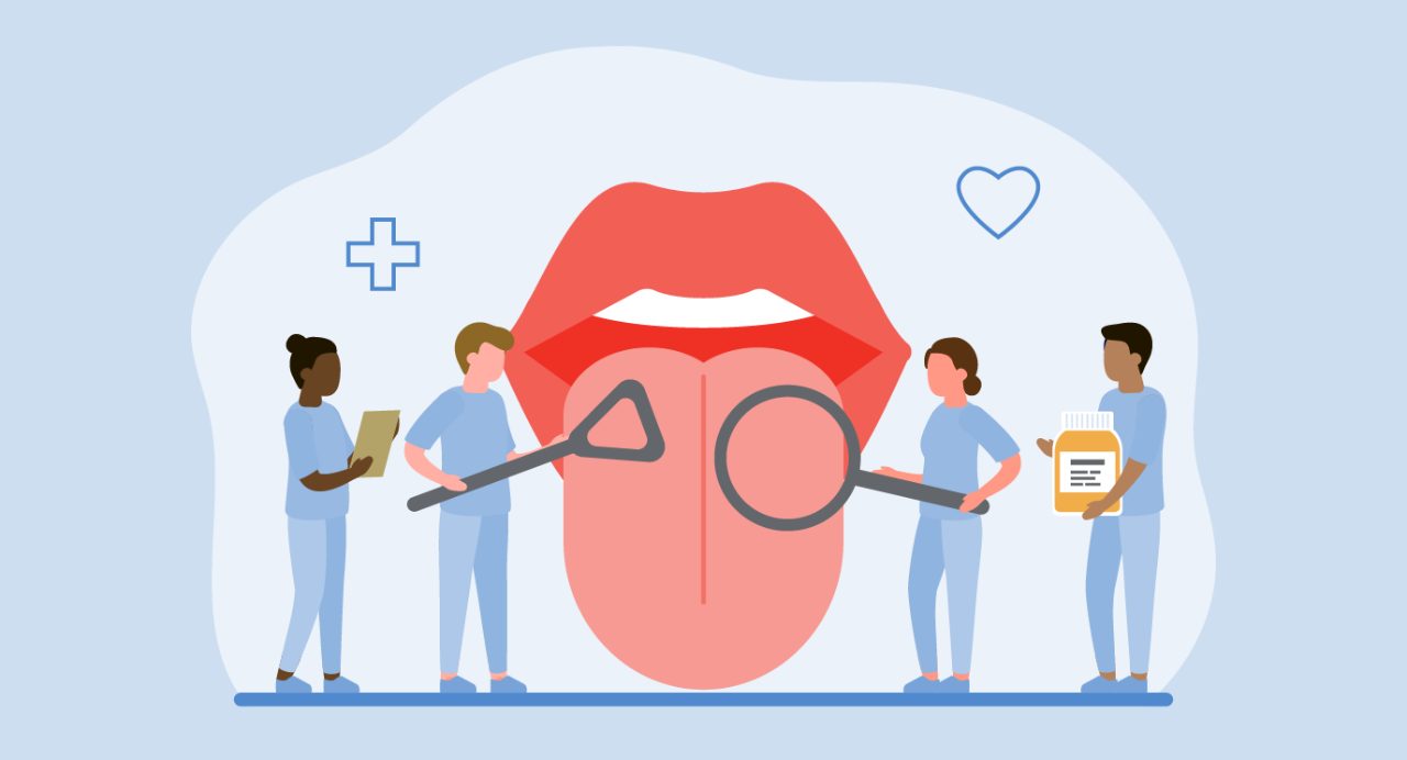 Mouth Sores from Chemotherapy | UT MD Anderson