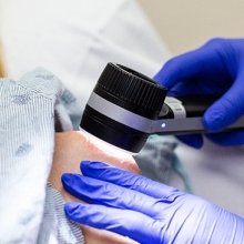 Melanoma - Symptoms, Staging & Treatment | MD Anderson Cancer Center