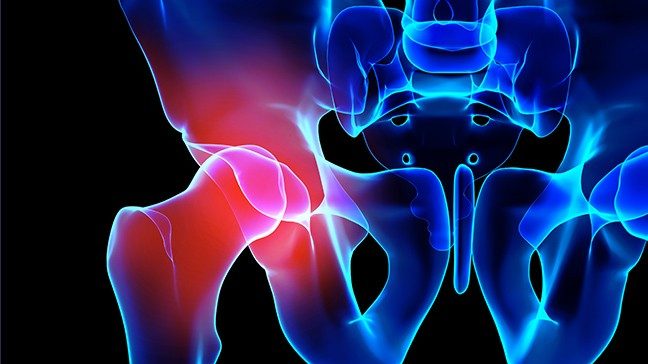 Close-up digital illustration of an X-ray view of pelvis