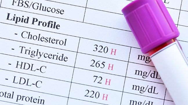 Close-up of lipid profile results report