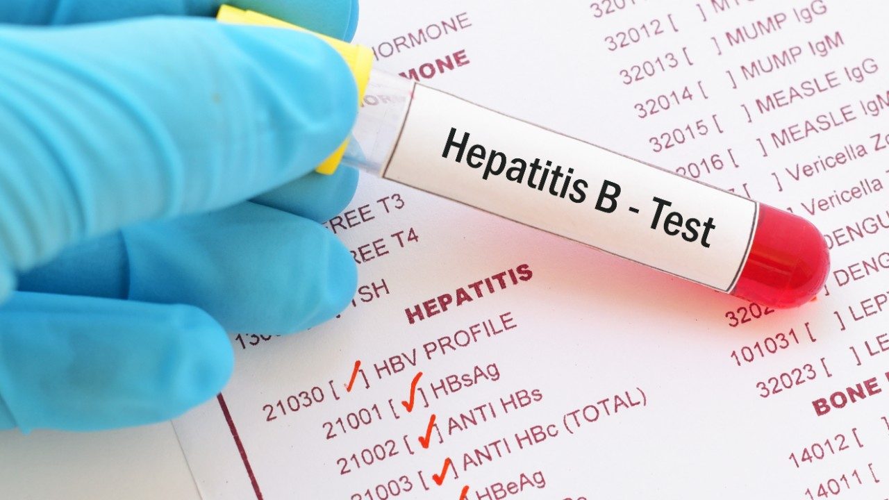 Blood sample with requisition form for hepatitis B virus (HBV) test