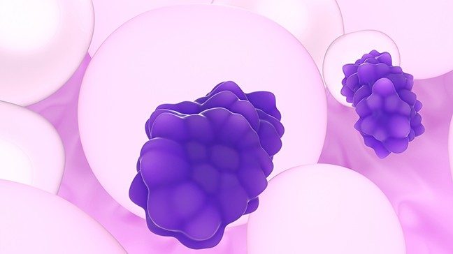 Illustration of liposarcoma. Colors used are pink and purple.