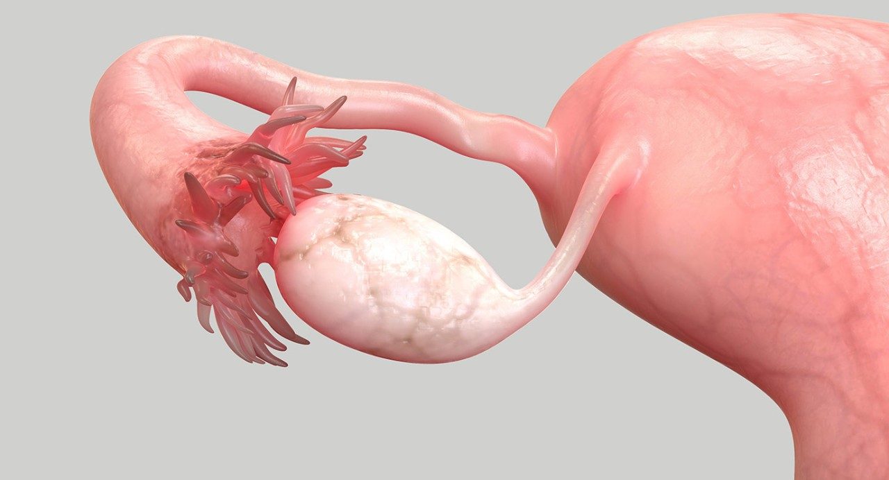 Anatomical illustration of a right ovary and fallopian tube against a gray background