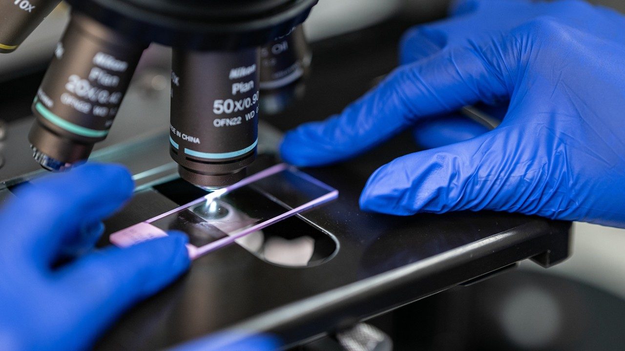 Hands in blue gloves adjust a slide under a microscope