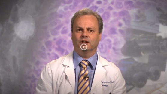 Residual Cancer Burden | UT MD Anderson