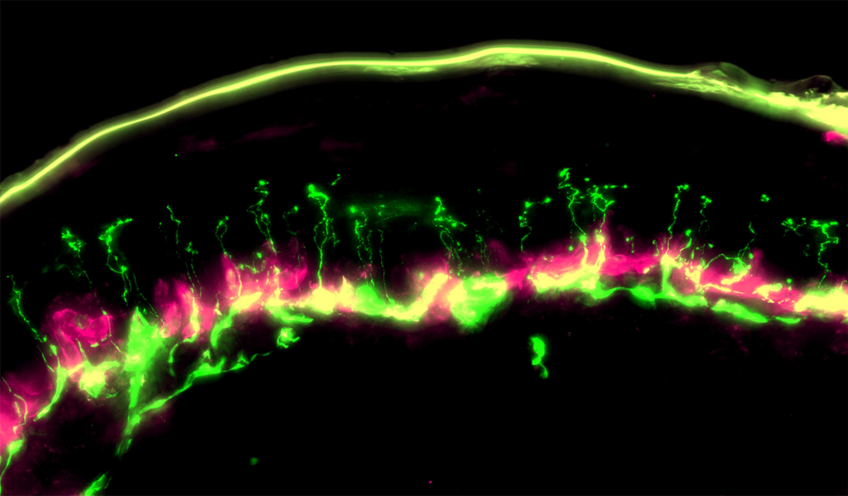 Psilocybin Prevents Chemotherapy-Related Nerve Injury and Associated Symptoms in Preclinical Models Psilocybin Prevents Chemotherapy-Related Nerve Injury and Associated Symptoms in Preclinical Models
