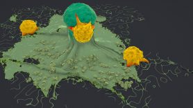 Immune cells (yellow) being attracted to a cancer cell (green).