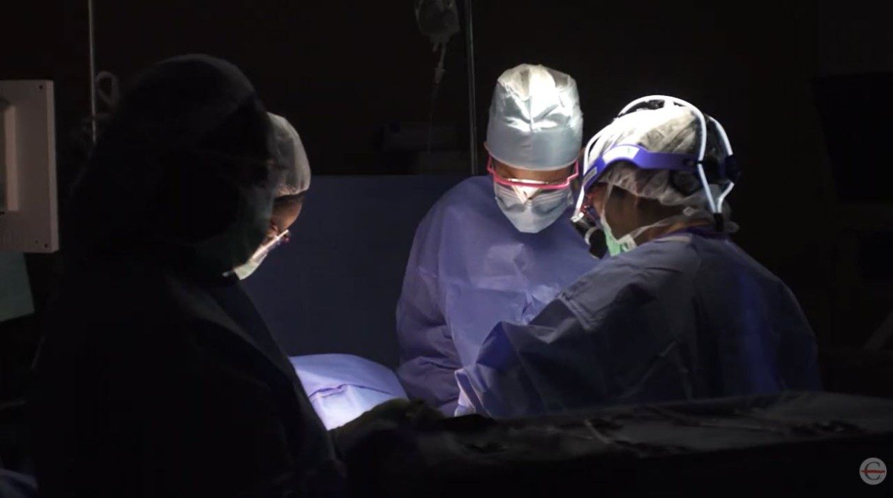 Slide with text "4 things to know about breast cancer surgery"