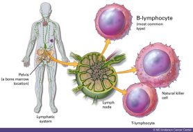 Non Hodgkins Lymphoma Cells Non Hodgkins Lymphoma Cells