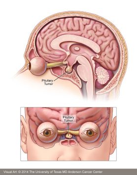 posterior pituitary tumours