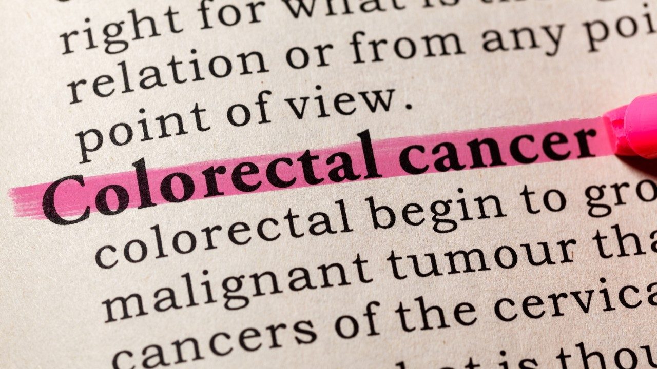 When Should You Start Colorectal Cancer Screening Md Anderson Cancer Center