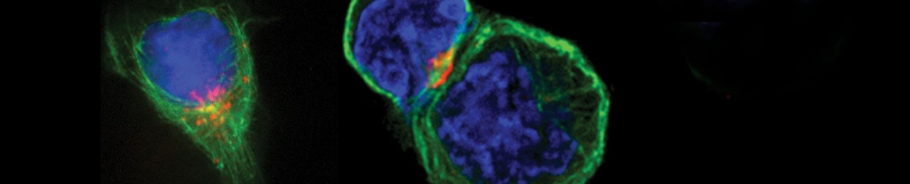 Cancer Biology 