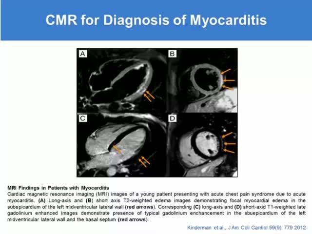 Slide showing CMR for diagnosis of myocarditis