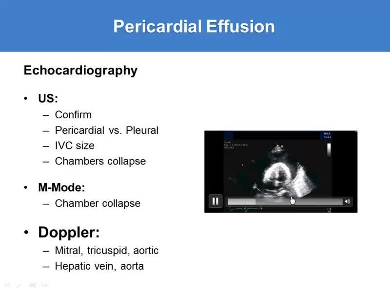 Slide showing pericardial effusion
