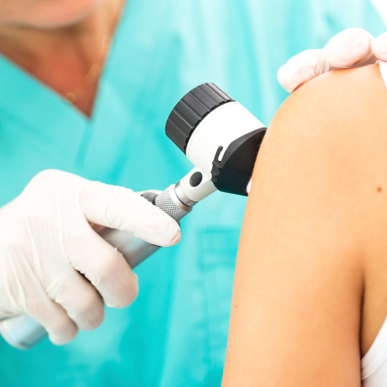 skin cancer screening