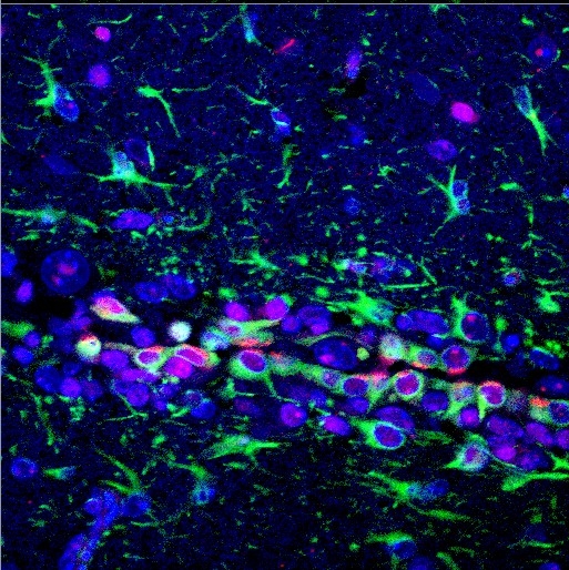 In mouse brain, astrocytes (GFAP: green) are infected with astrocyte-specific Cre adenovirus (Cre: red.) (Nuculear staining: blue)