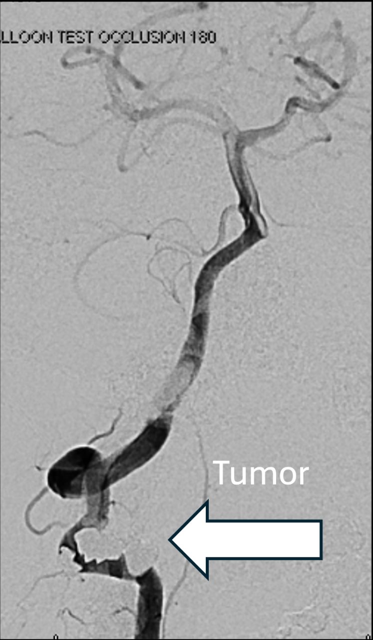 Sections UT MD Anderson