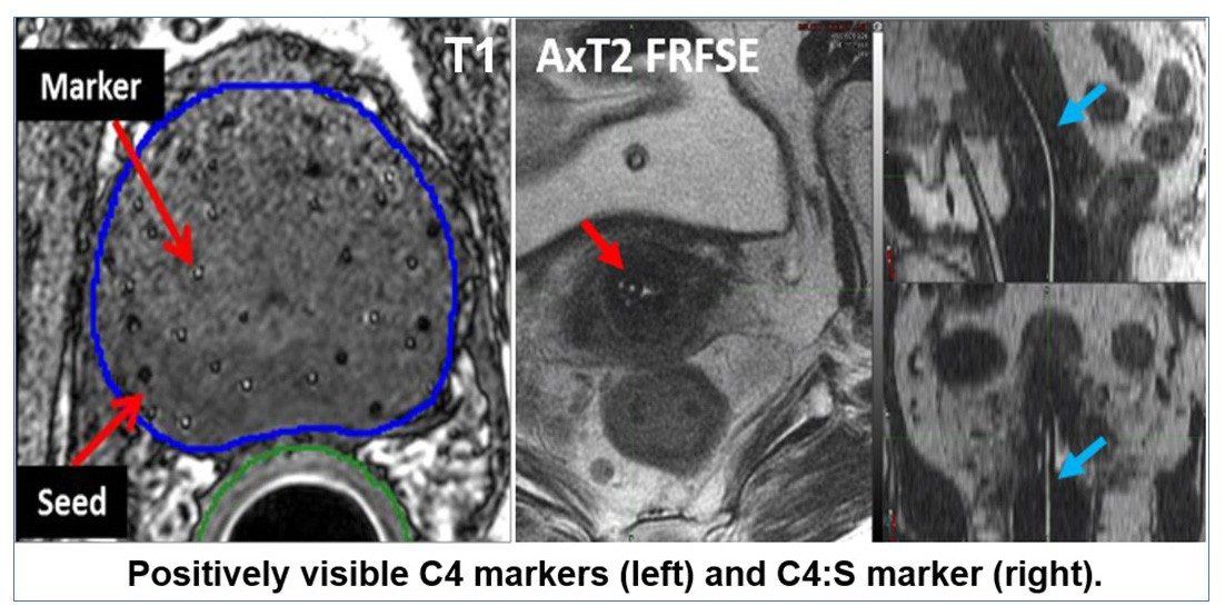 Frank Lab Research | UT MD Anderson