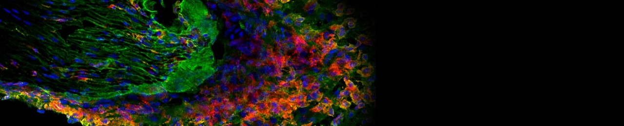 Peter Grace Lab - image from a confocal microscope