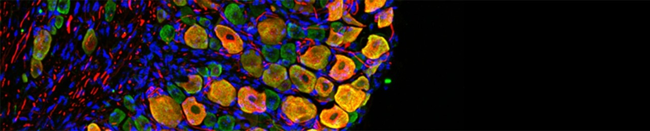 Shepherd Lab - image of cells from a confocal microscope
