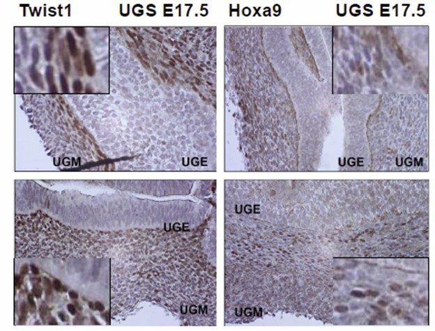 Microscopy images of TWIST1 and HOXA9 IHC on serial sections of E17.5 UGS from wild-type mice in cells at the urogenital mesenchyme (UGM)–urogenital epithelium (UGE) interface.