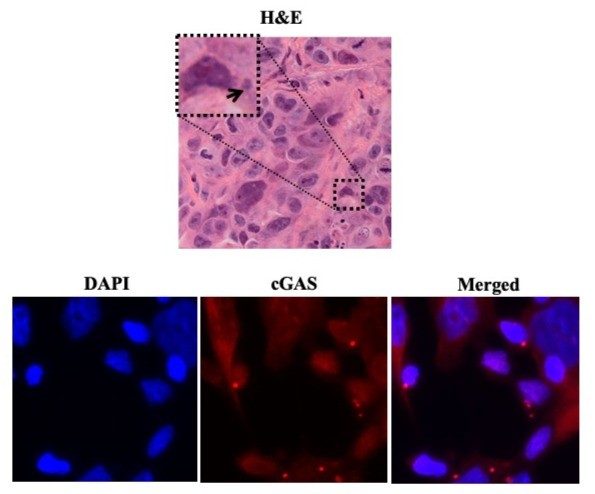 Representative H&E staining of H358 xenograft tumor tissue showing regions of micronuclei positive cells. Representative IF images of DAPI (blue) and cGAS (red) after treatment.