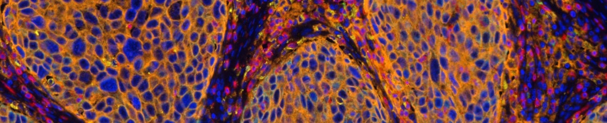 Fluorescent microscope image of tissue