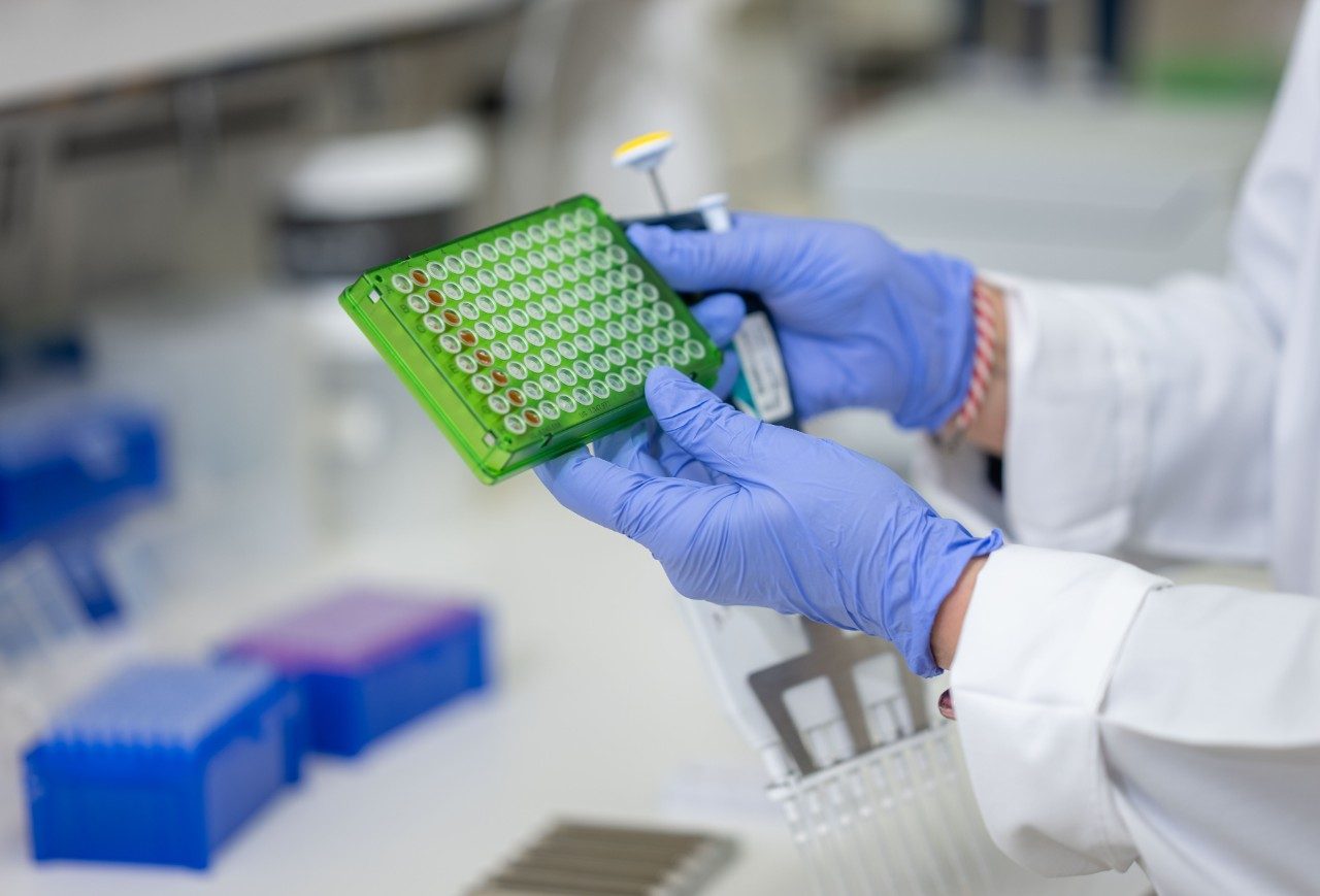 Close-up of gloved hands holding a green 96-well plate and a multichannel pipette in a laboratory setting. Pipette tip boxes and other lab tools are visible on the bench.