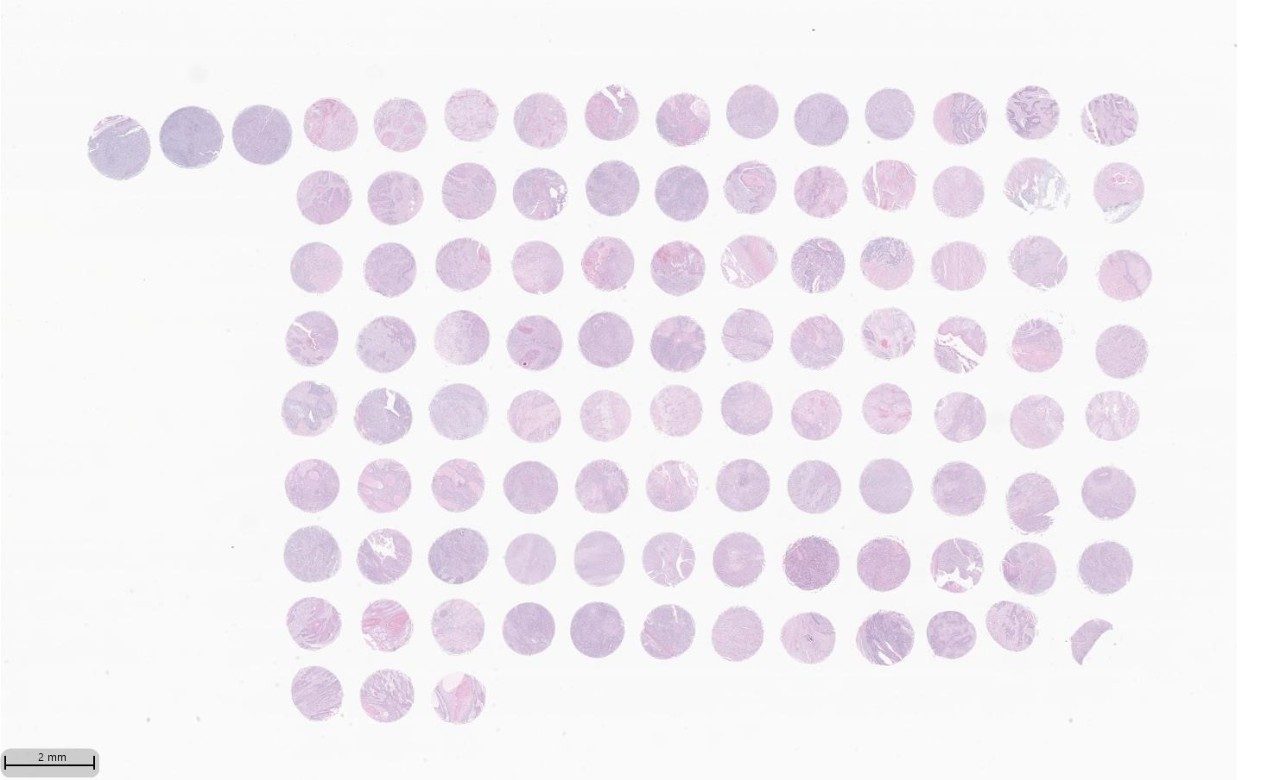 Grid of circular tissue samples stained in shades of purple and pink on a white background.