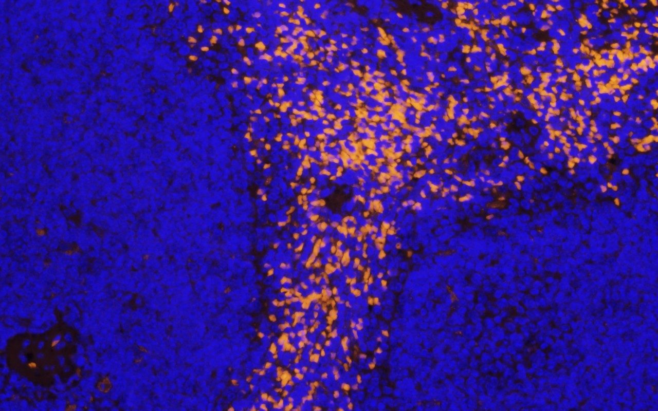 Fluorescent microscopy image showing blue and bright orange clusters against a black background.