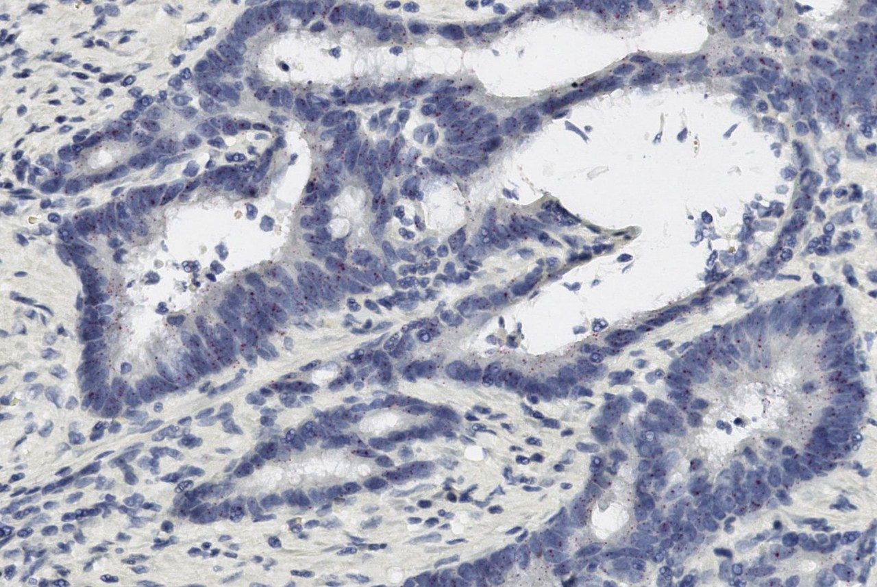 Microscopic image of tissue section showing glandular structures with dark-stained nuclei and light cytoplasm.