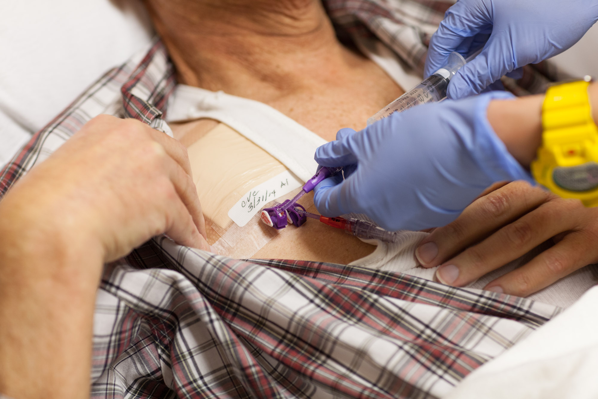 Leukemia Treatment Chemotherapy