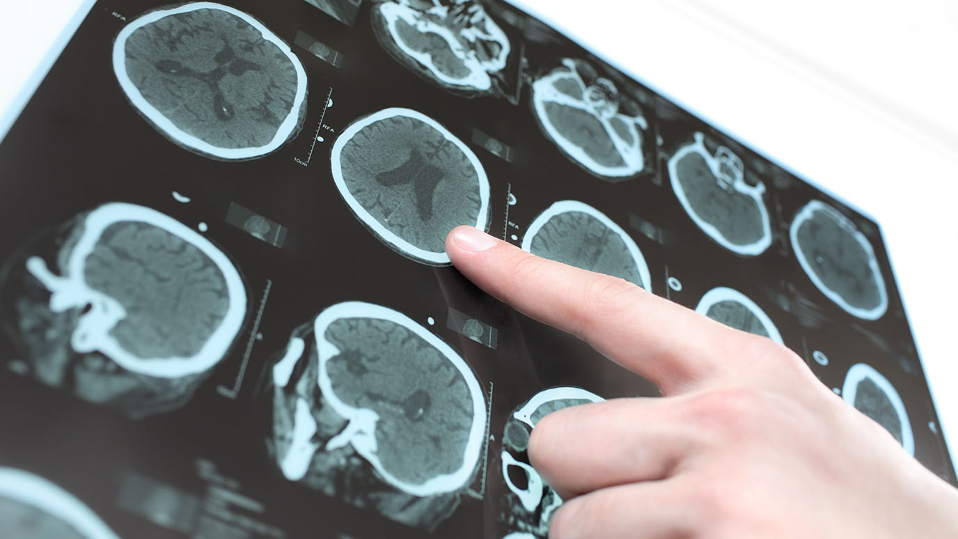 Combination Immunotherapy Improves Survival For Patients With 