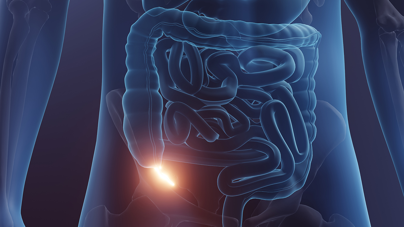 Tumor markers in rare appendiceal cancer may predict treatment outcomes ...