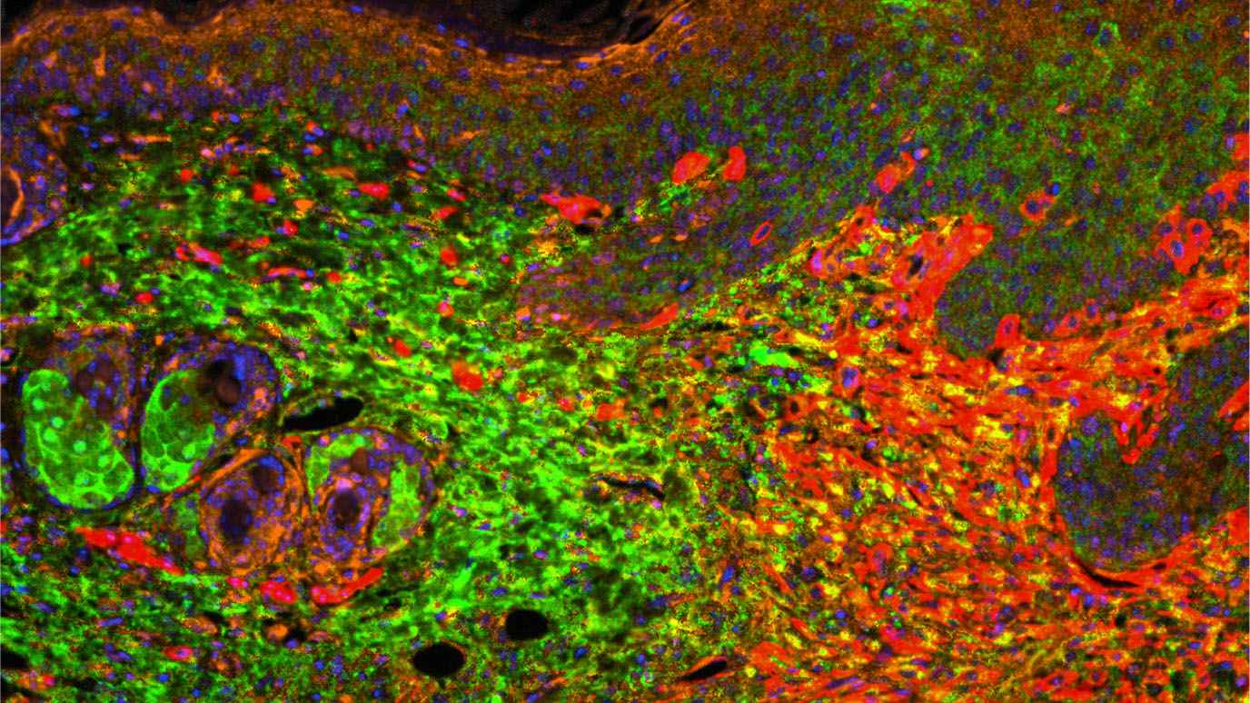 MD Anderson Research Highlights for March 9, 2022 MD Anderson Cancer