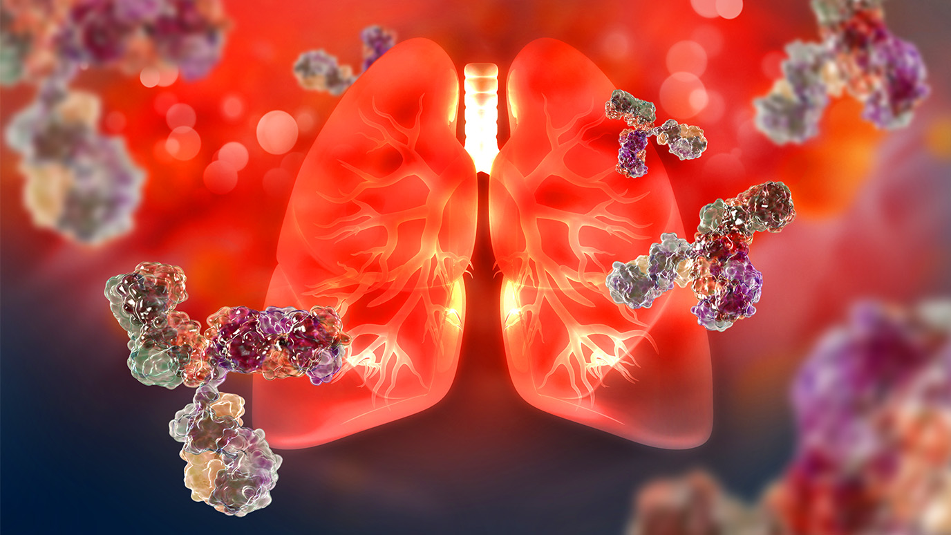 Combination immunotherapy effective before lung cancer surgery | UT MD ...